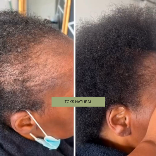The Best Hair Growth Products for Thinning, Shedding, and Damaged Hair