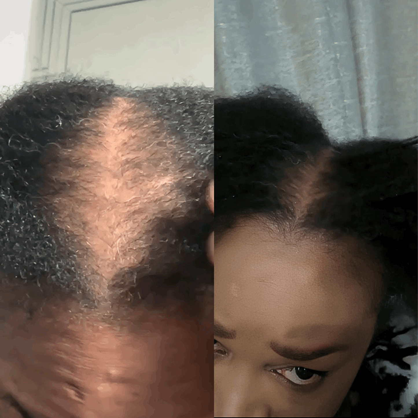 Growth Revive Herbal Hair Growth Oil - TOKS NATURAL