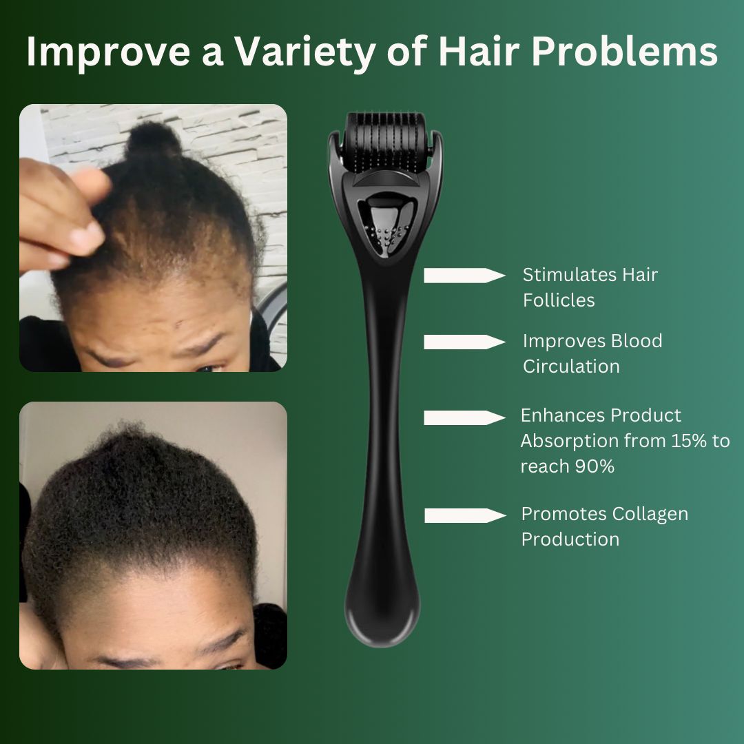 Hair Growth Derma Roller 0.3mm - TOKS NATURAL