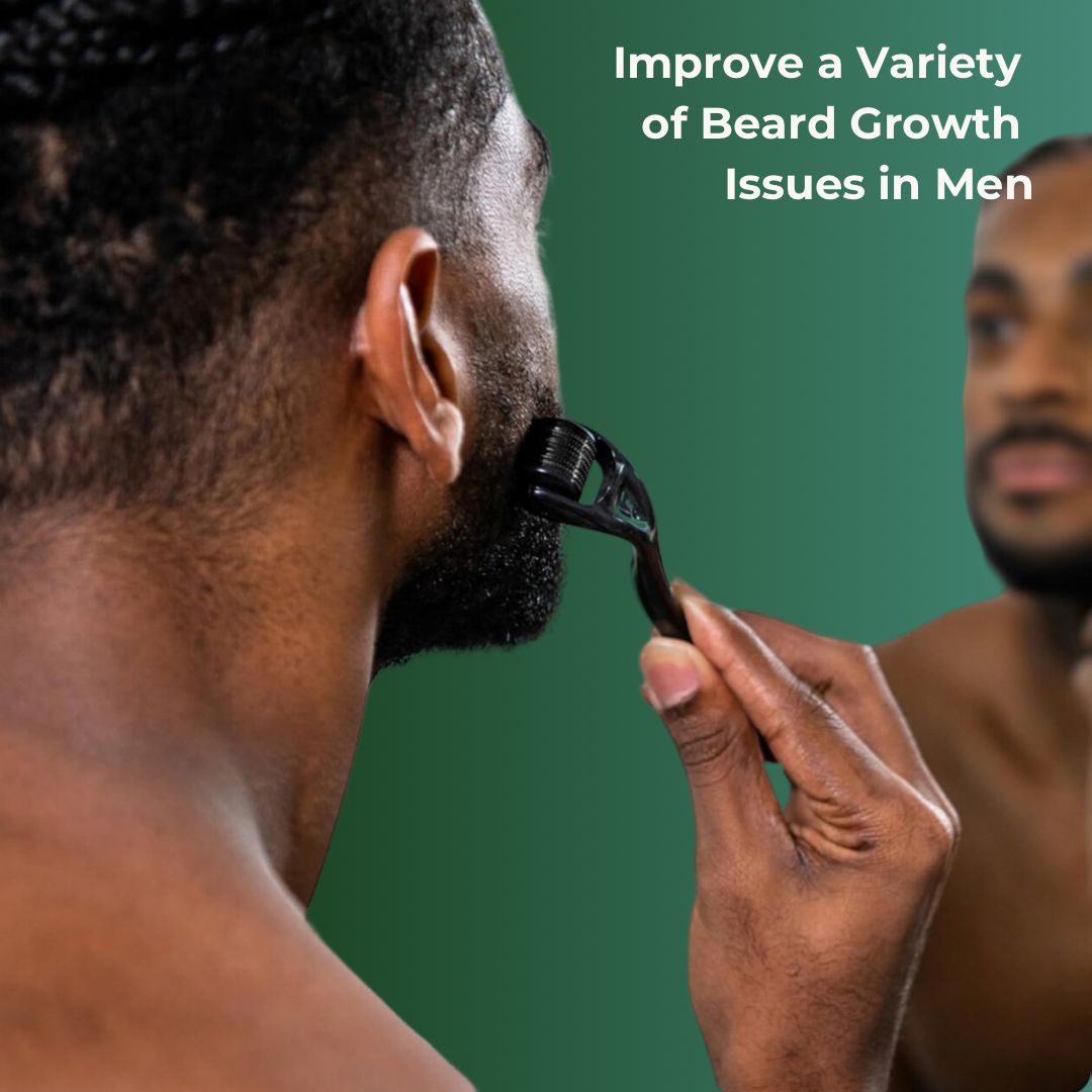 Hair Growth Derma Roller 0.3mm - TOKS NATURAL