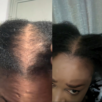 Growth Revive Herbal Beard & Hair Growth Oil