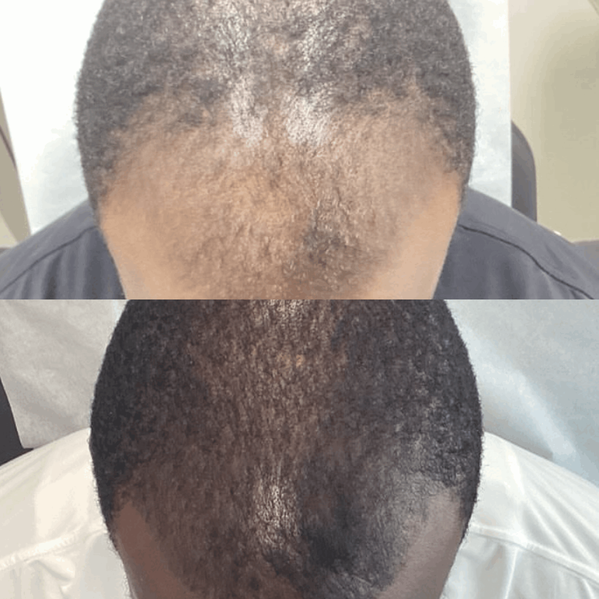 Growth Revive Herbal Hair Growth Oil - TOKS NATURAL
