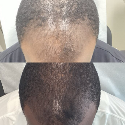 Growth Revive Herbal Beard & Hair Growth Oil