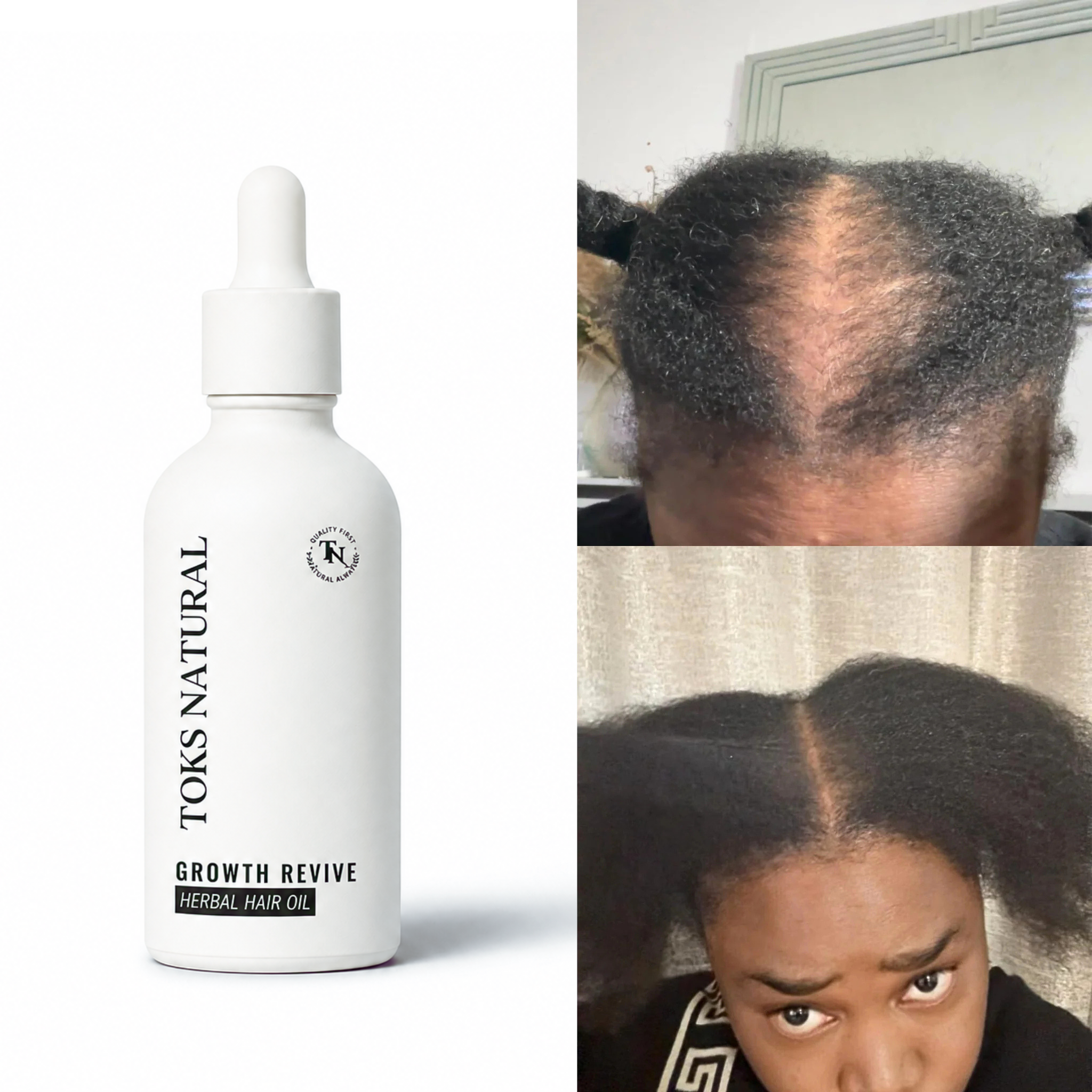 Toks Natural Growth Revive hair oil bottle with before and after hair growth images.