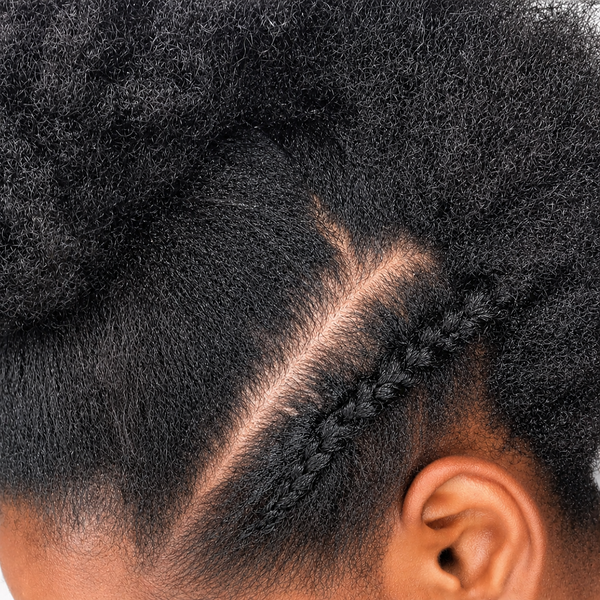Blocked Scalp