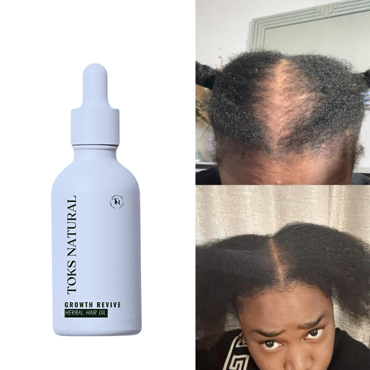 Toks Natural Growth Revive hair oil bottle with before and after hair growth comparison on a white background.